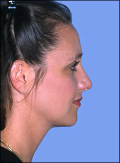 Patient 104 - Front View