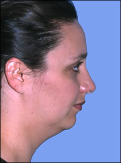 Patient 104 - Front View