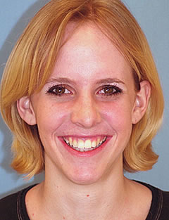 Patient 123 - Front View
