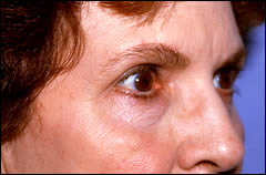 Patient 242 - Front View