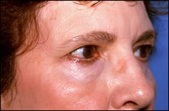Patient 242 - Front View