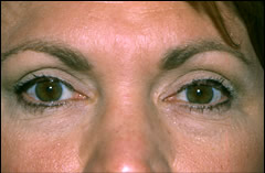 Patient 253 - Front View