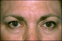 Patient 253 - Front View