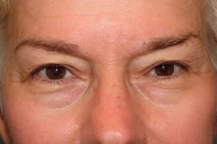 Patient 255 - Front View