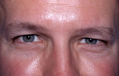 Patient 256 - Front View