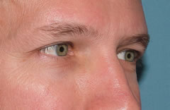 Patient 256 - Front View