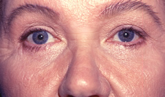 Patient 257 - Front View