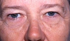 Patient 257 - Front View