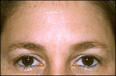Patient 302 - Front View