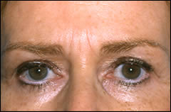 Patient 304 - Front View