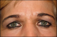 Patient 305 - Front View