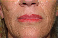 Patient 401 - Front View Before